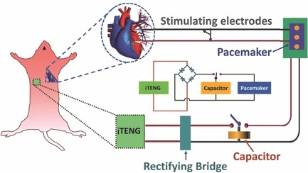 1)In Vivo Powering of Pacemaker by Breathing‐Driven Implanted Triboelectric Nanogenerator